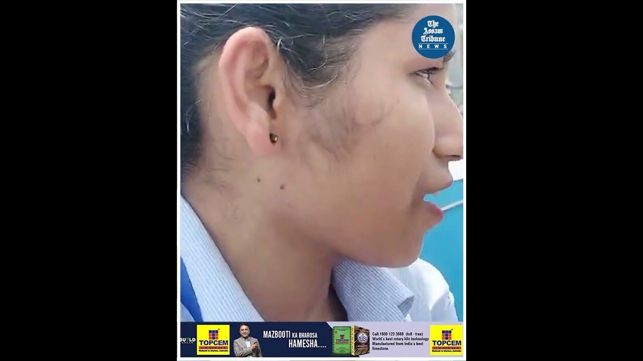 Two injured as speeding car rams down two-wheeler in Guwahati